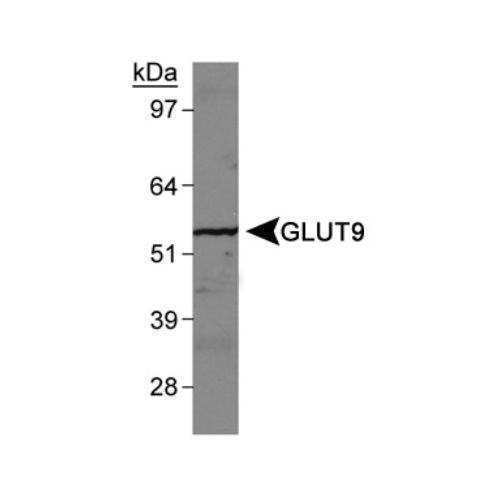 GLUT9 antibody