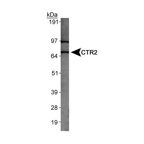 Probable low affinity copper uptake protein 2 antibody