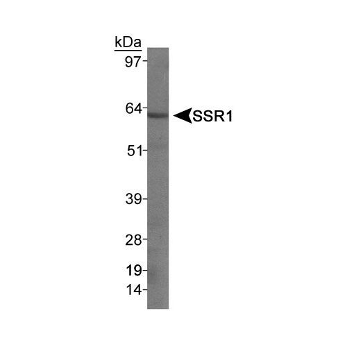 Somatostatin Receptor 1 (SSR1) antibody