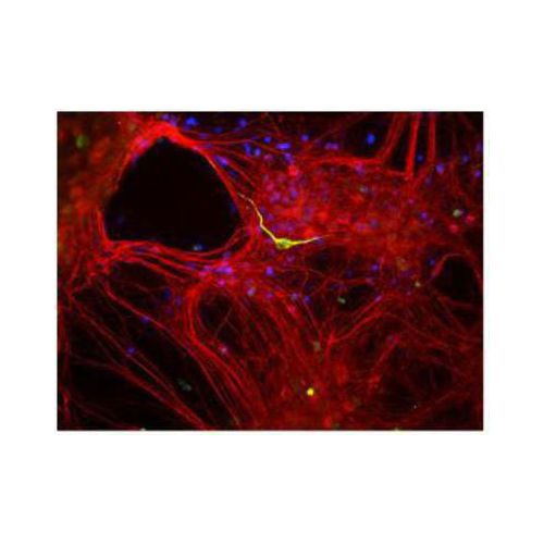 Internexin alpha antibody