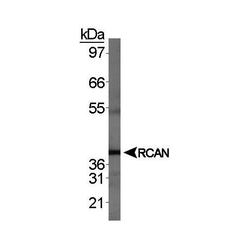 RCAN1 antibody