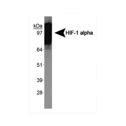 Hypoxia-inducible factor 1-alpha [exon 10] antibody