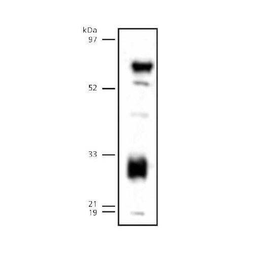 Endothelial lipase antibody