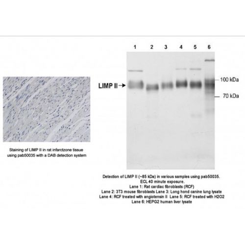 Lysosome membrane protein 2 (LIMPII/lgp85) antibody