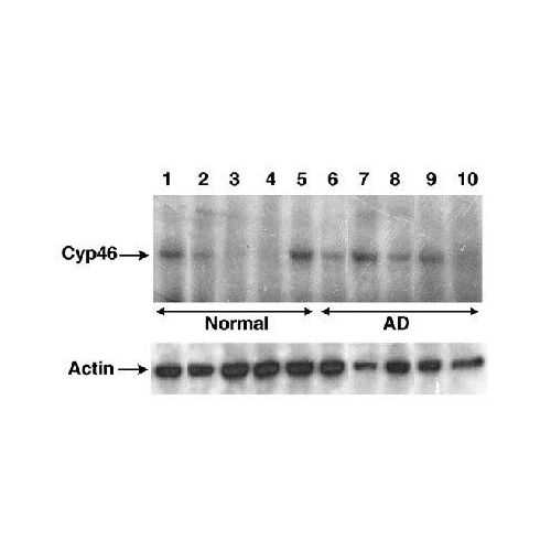 Cholesterol 24-hydroxylase antibody