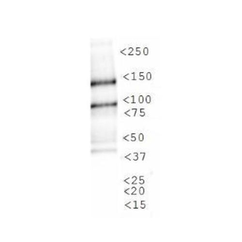 JMJD1A antibody