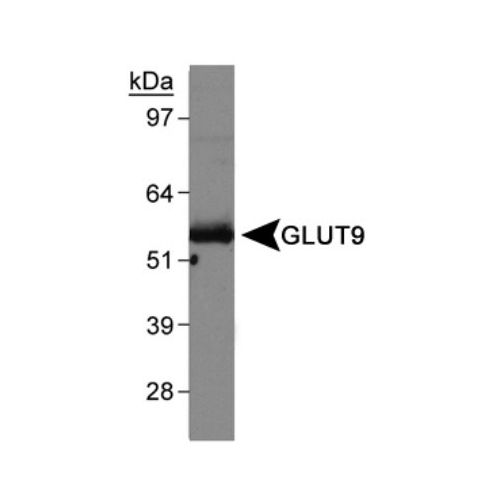 GLUT9 antibody