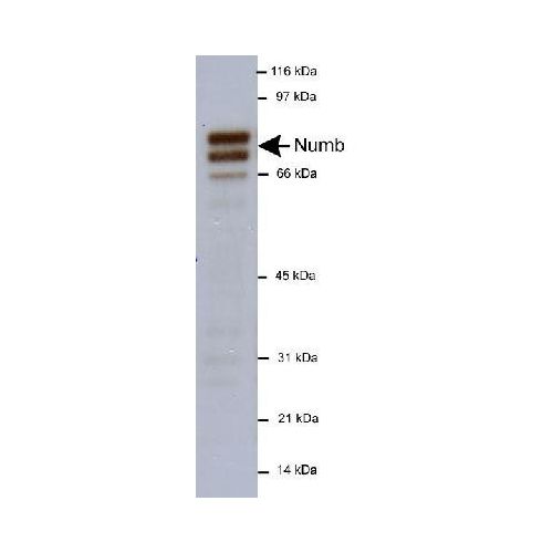 NUMB antibody