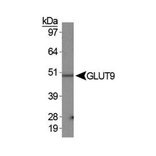 GLUT9 antibody