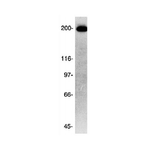 ch-TOG antibody