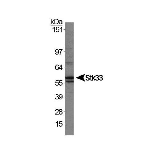 Serine/threonine-protein kinase 33 antibody