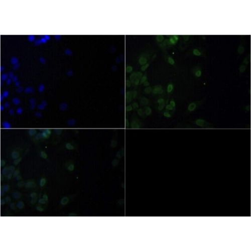 Ragulator complex protein LAMTOR1 antibody