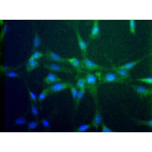 C-C chemokine receptor type 2 (CCR2 / CD192) antibody