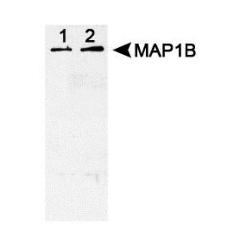MAP1B [p Thr1265] antibody (SuperBUGS)