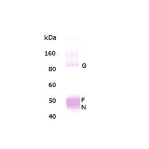 Respiratory Syncytial Virus antibody