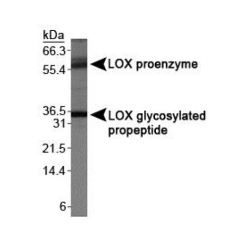 LOX propeptide antibody