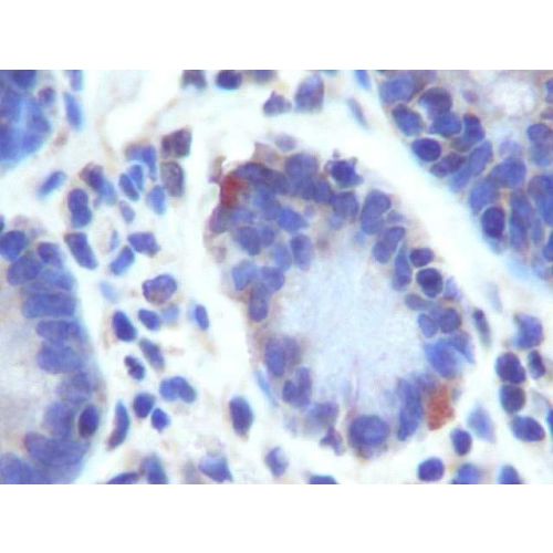 GPR49 (LGR5) antibody