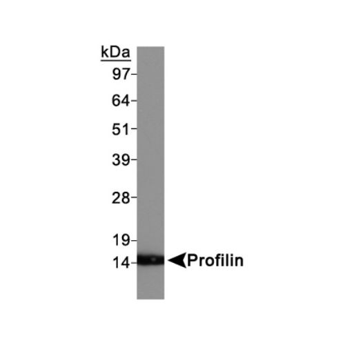 Profilin 1 antibody