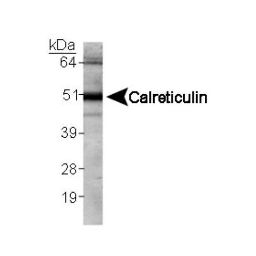 Calreticulin antibody