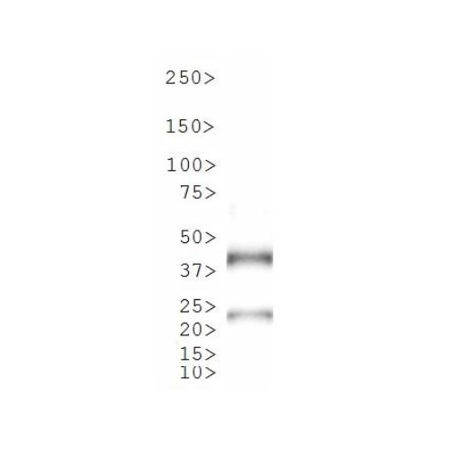 TetR antibody