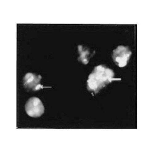 Nucleolin antibody
