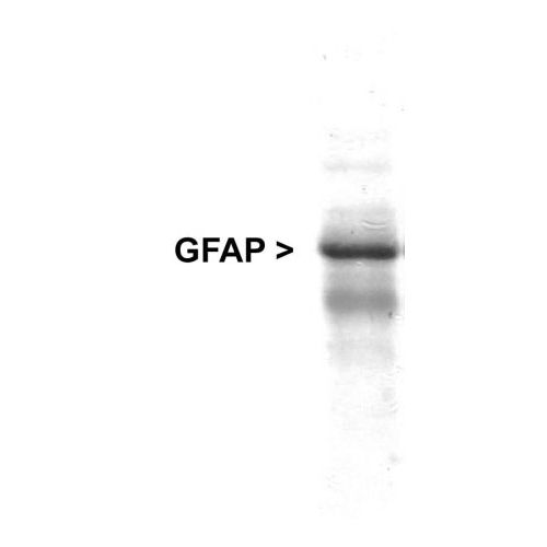 Glial Fibrillary Acid Protein (GFAP) antibody