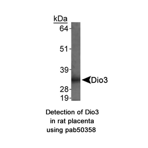 Type III iodothyronine deiodinase antibody