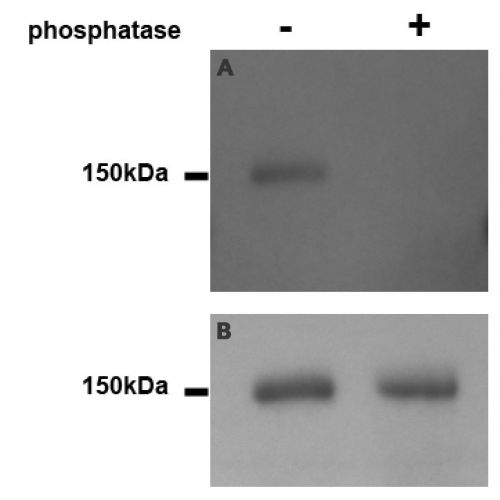 AMOTL1 pS262 antibody