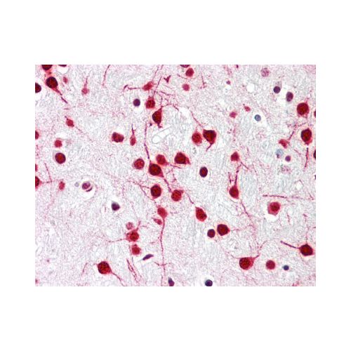 KIAA0141 (N-Terminus) antibody