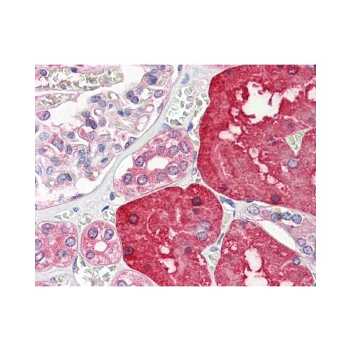 ACY1 / Aminoacylase 1 antibody