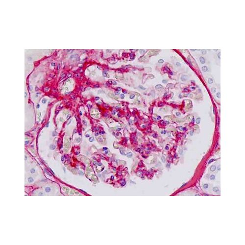 Collagen IV antibody