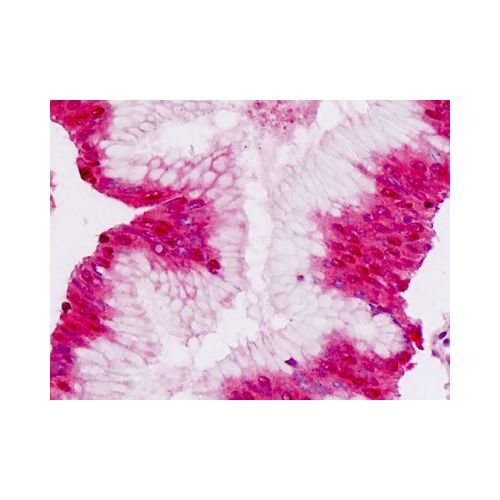 CDH3 / P-Cadherin (N-Terminus) antibody