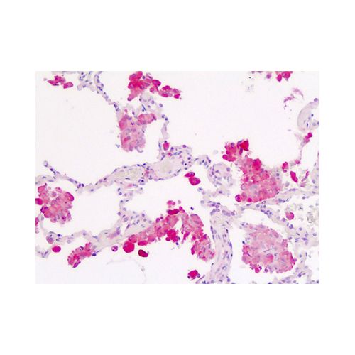 IL1RA / IL1R1 (C-Terminus) antibody