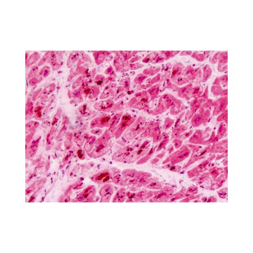 PUM2 (Ser182) antibody