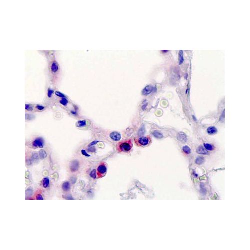 SFTPC / Surfactant Protein C (aa143-173) antibody
