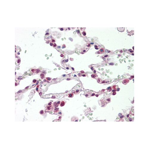 ASCL1 / MASH1 antibody