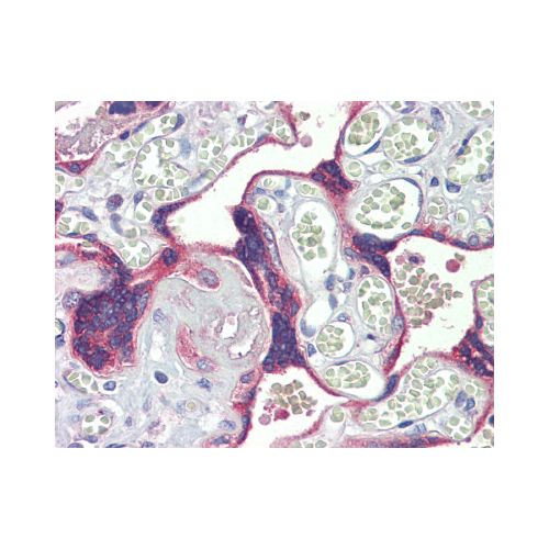 DSC3 / Desmocollin 3 (aa821-850) antibody