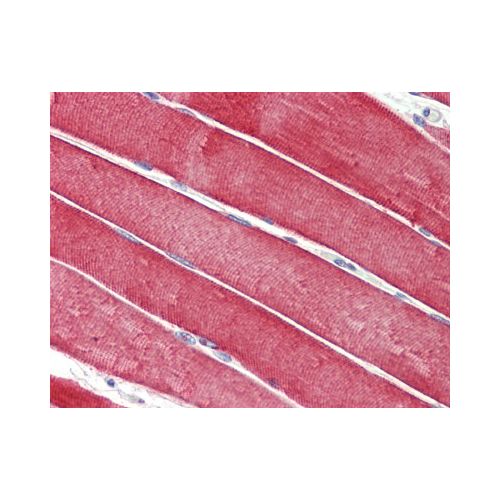 DNAJC5 / CSP (aa177-191) antibody