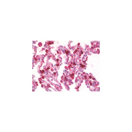 SFTPA1 + SFTPA2 (aa102-115) antibody