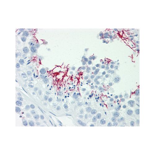 GAK (aa101-150) antibody