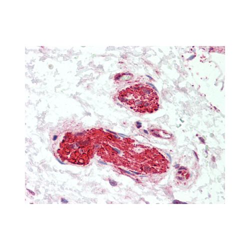 LMTK3 (aa1251-1300) antibody