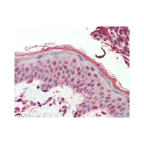 SWR1 / SRCAP (aa309-322) antibody
