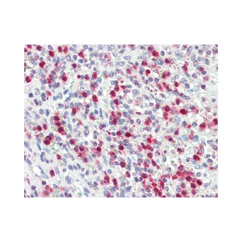 Proteinase 3 / PRTN3 (aa88-98) antibody