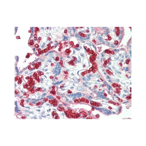 Erythrocytes antibody