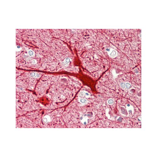 TAC3 / Tachykinin (aa53-83) antibody