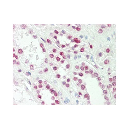 TLX1 / HOX11 (aa162-191) antibody