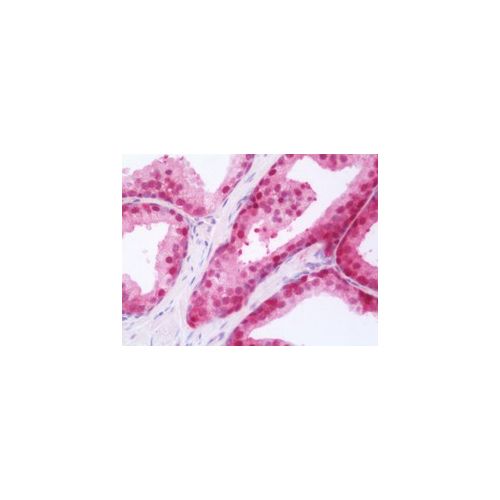 RARG / RAR-Gamma antibody