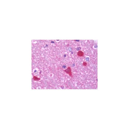 PPP3CB (aa1-228) antibody