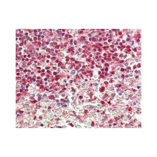 ACTG1 / Gamma Actin (aa188-215) antibody