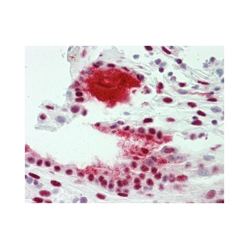 TROP2 / TACSTD2 (aa131-180) antibody